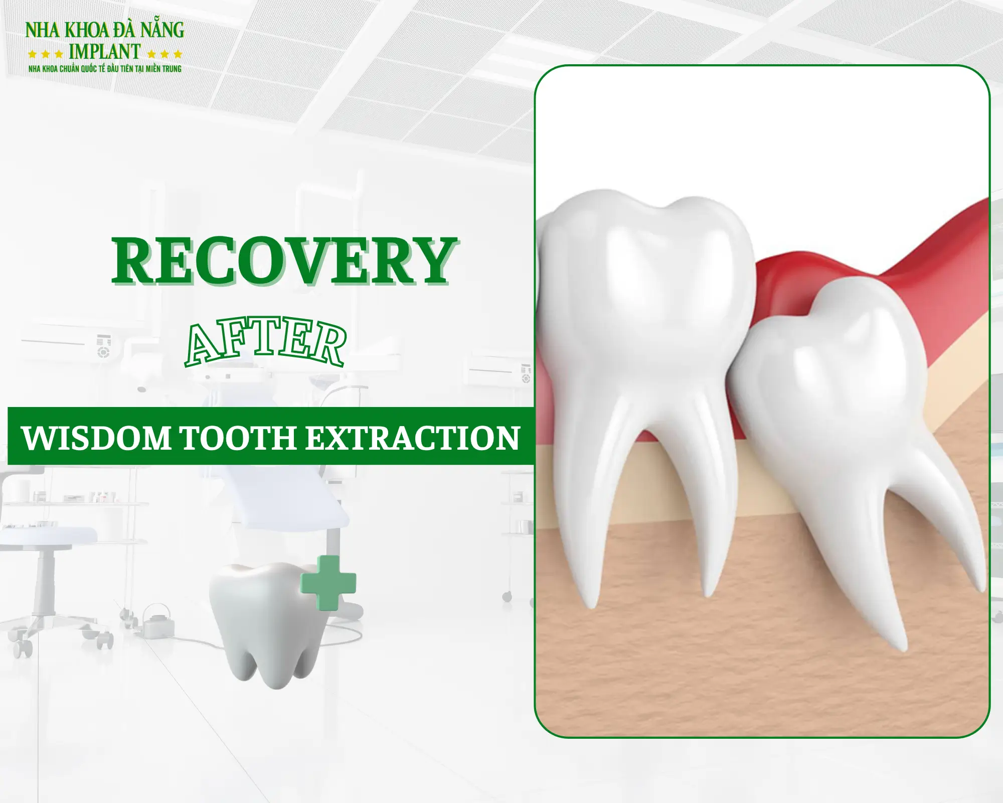 What happens after wisdom tooth extraction – Recover quickly with this simple tip