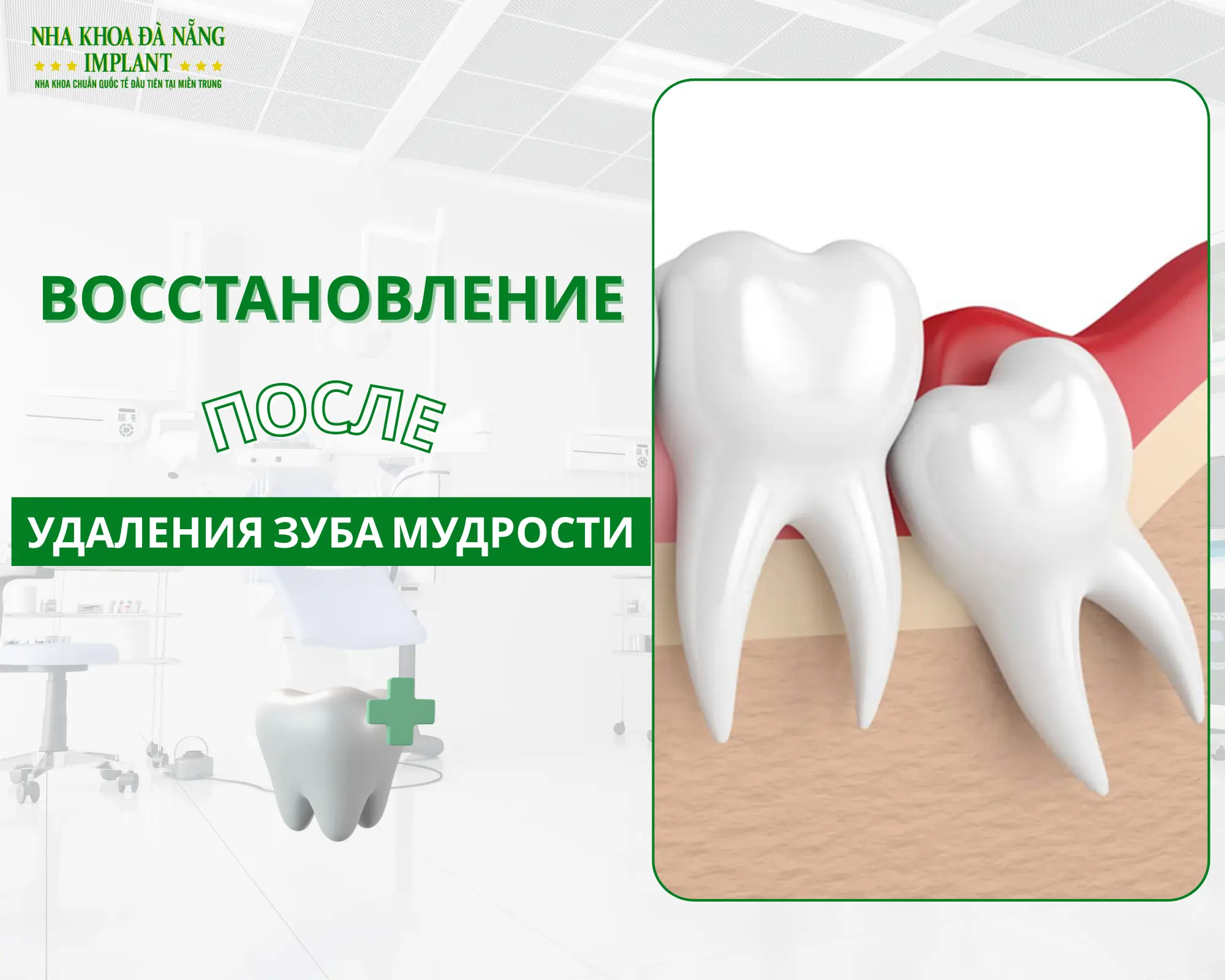 Удаление зуба мудрости – быстрое восстановление с простым советом