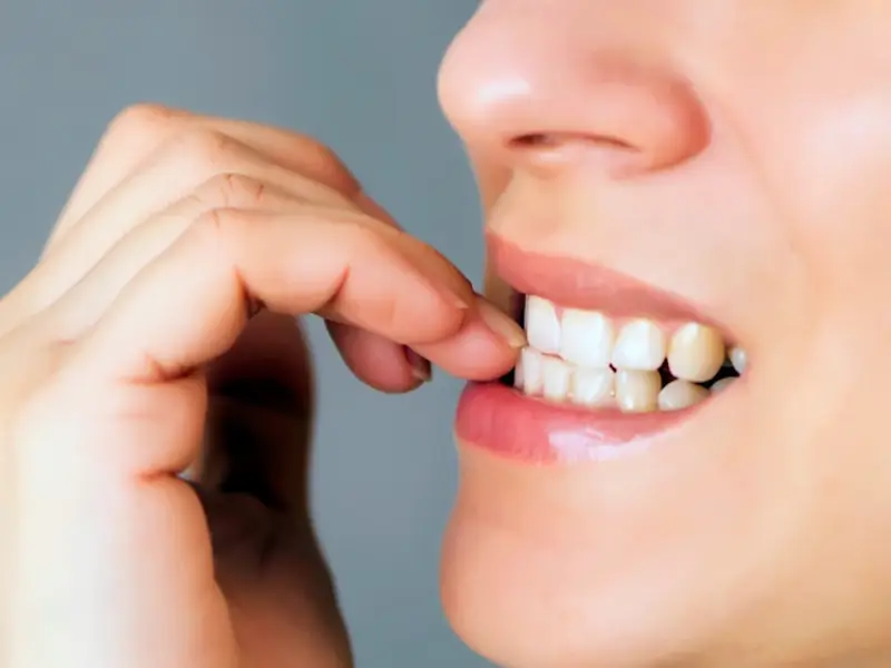 Cách chăm sóc răng sau khi niềng răng để không bị chạy lại – Hướng dẫn chi tiết từ Nha Khoa Đà Nẵng Implant