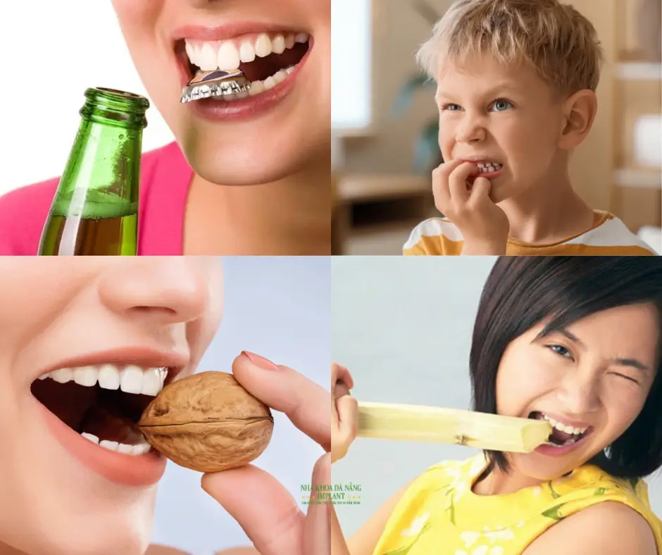 10 тихих привычек, которые ежедневно вредят вашим зубам – предупреждение от Da Nang Implant Dental Clinic