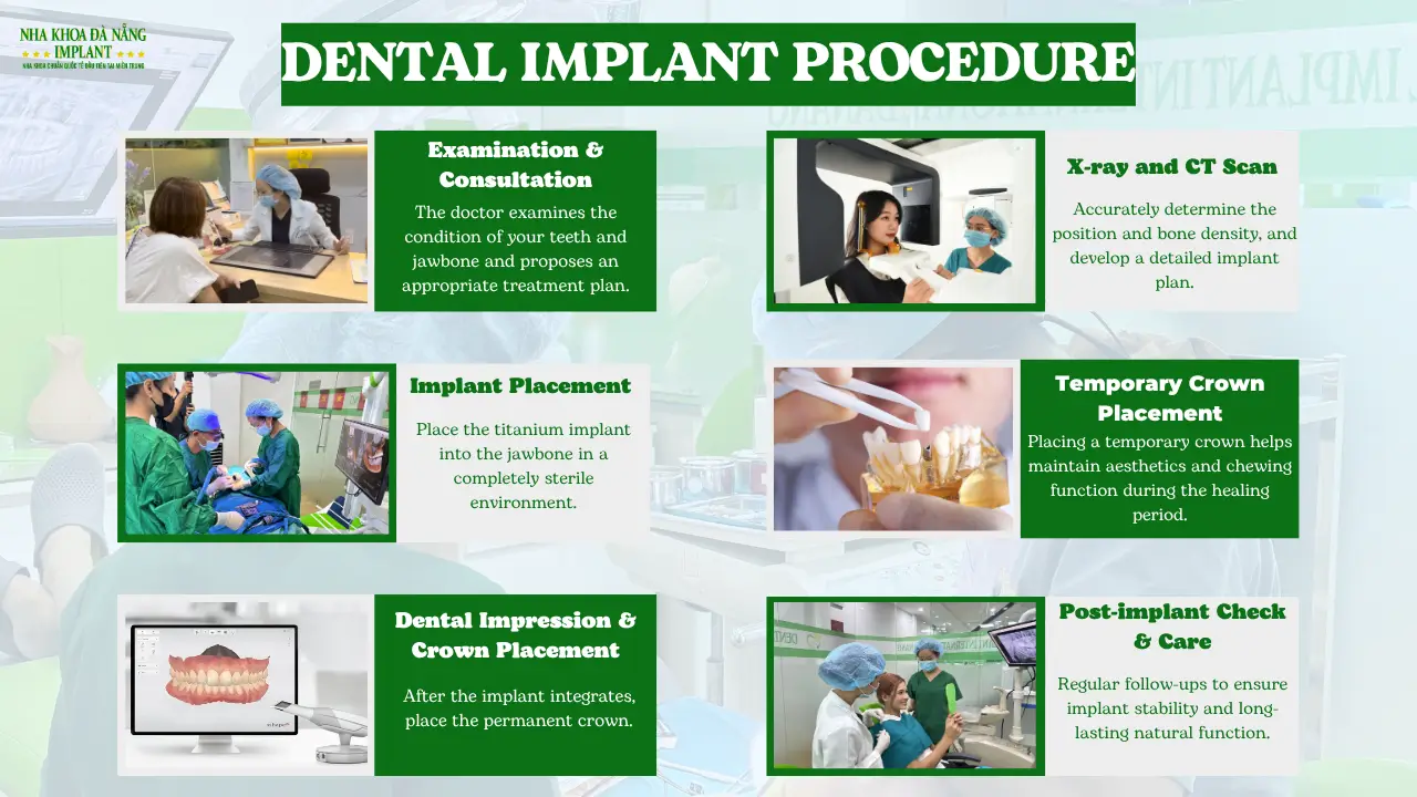 medical-standard implant procedure at Da Nang Implant Dental Clinic