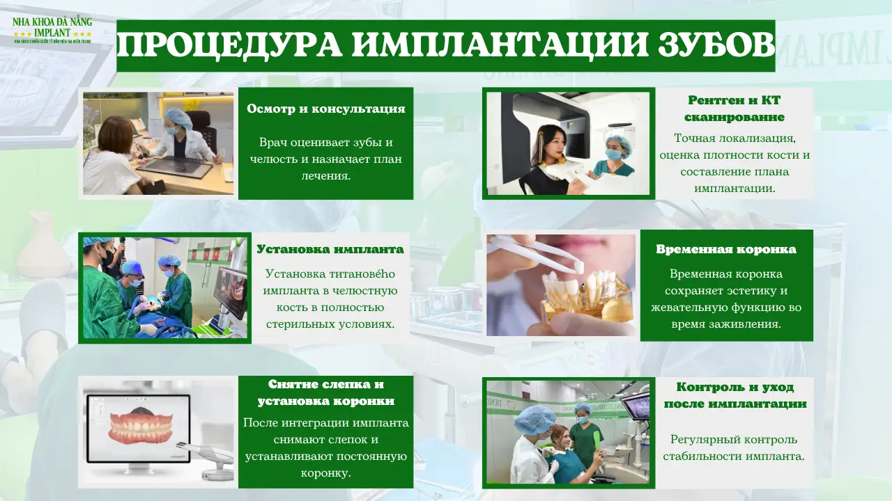 процедура имплантации по медицинским стандартам в Da Nang Implant Dental Clinic