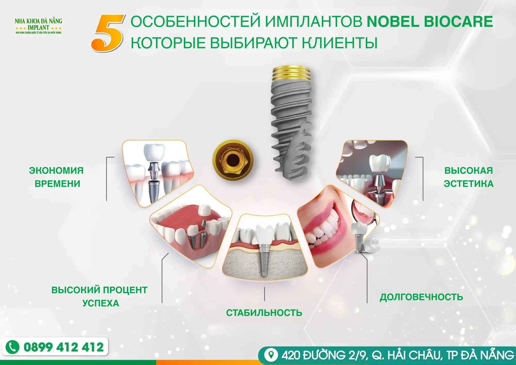 5 Характеристик имплантов Nobel Biocare – Решение для восстановления зубов которое выбирают многие клиенты 11 5 Выдающихся особенностей имплантов Nobel Biocare