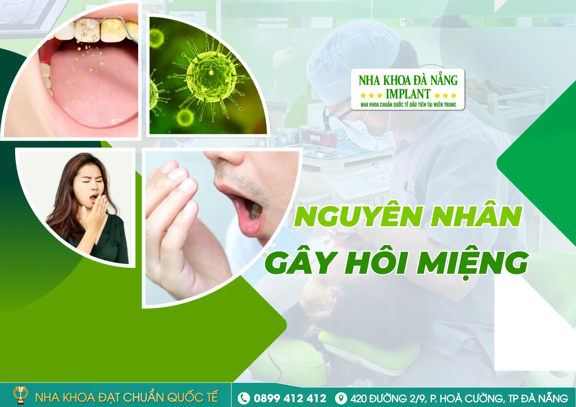 Hôi Miệng Buổi Sáng Có Phải Vì Miệng “Ngủ Chung” Với Vi Khuẩn? Nguyên Nhân – Cách Khắc Phục Hiệu Quả