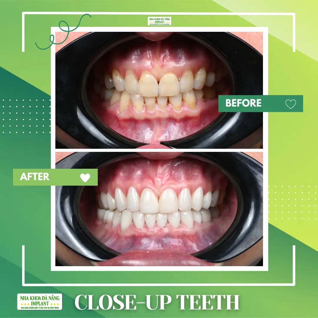 Pre-treatment images