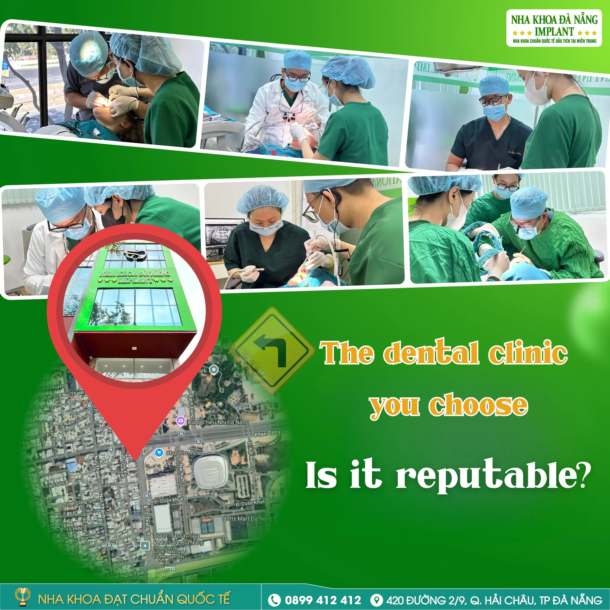 Don’t rush into getting porcelain crowns if you don’t know these 5 things 9 Da Nang Implant Dental Clinic – An international-standard dental clinic in Central Vietnam