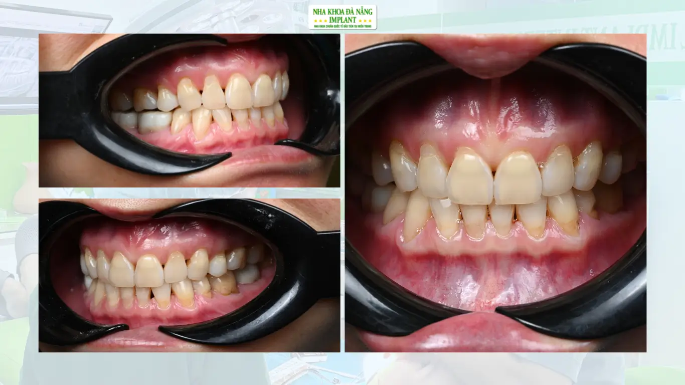 Tình trạng trước điều trị