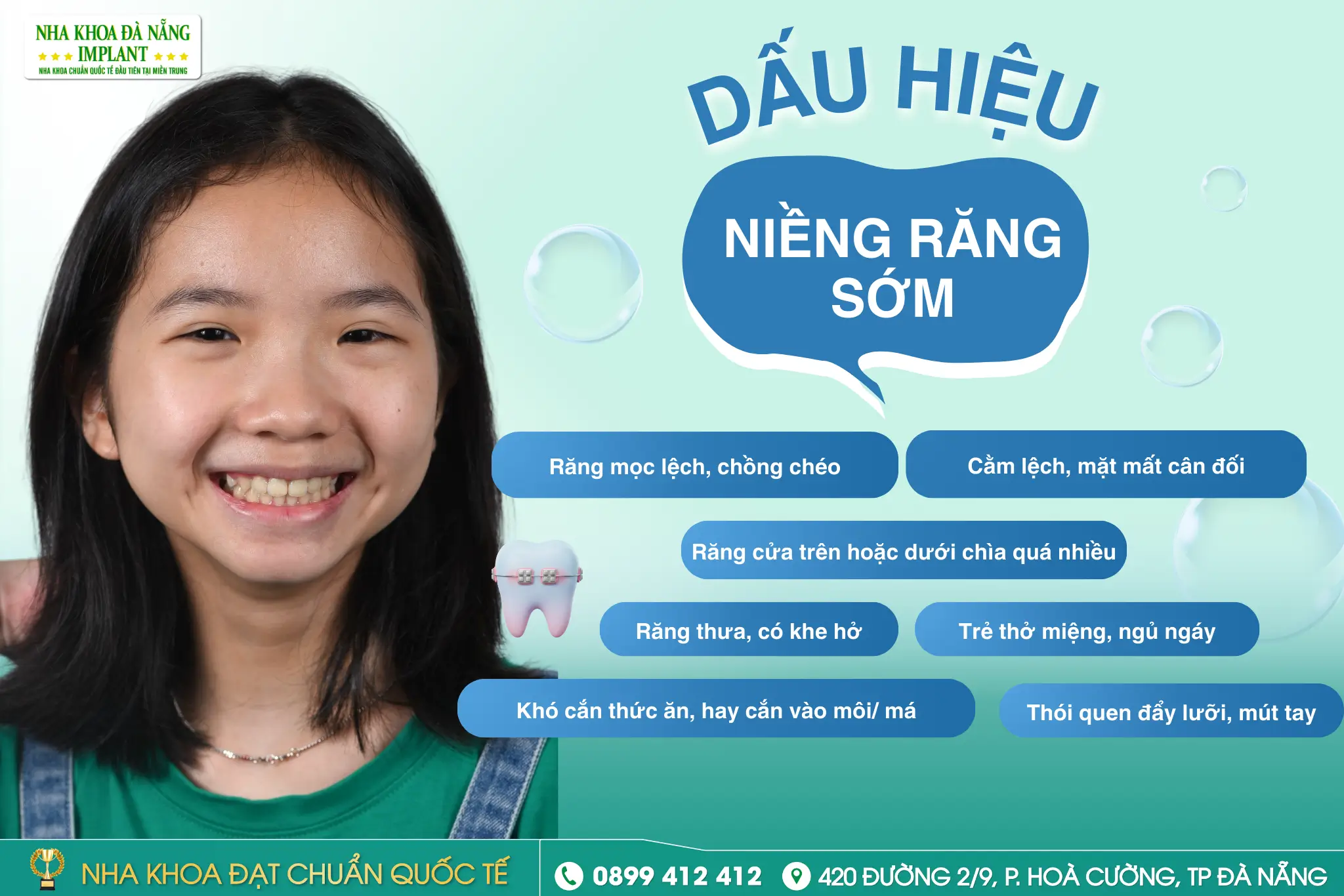 Dấu hiệu trẻ cần niềng răng sớm