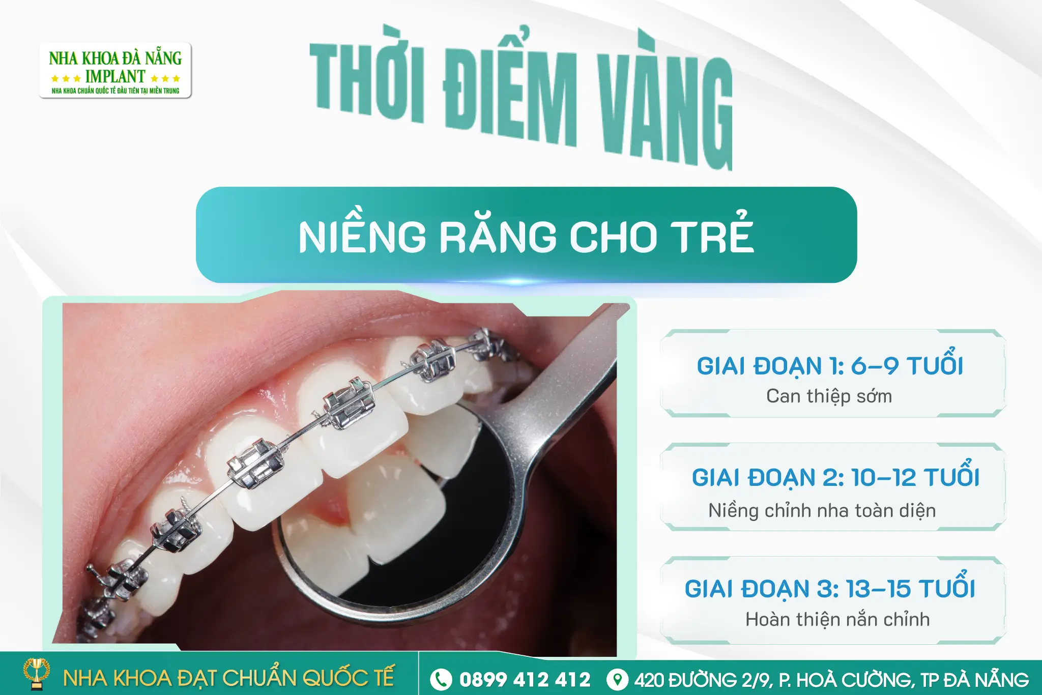 Khi nào nên niềng răng cho trẻ?