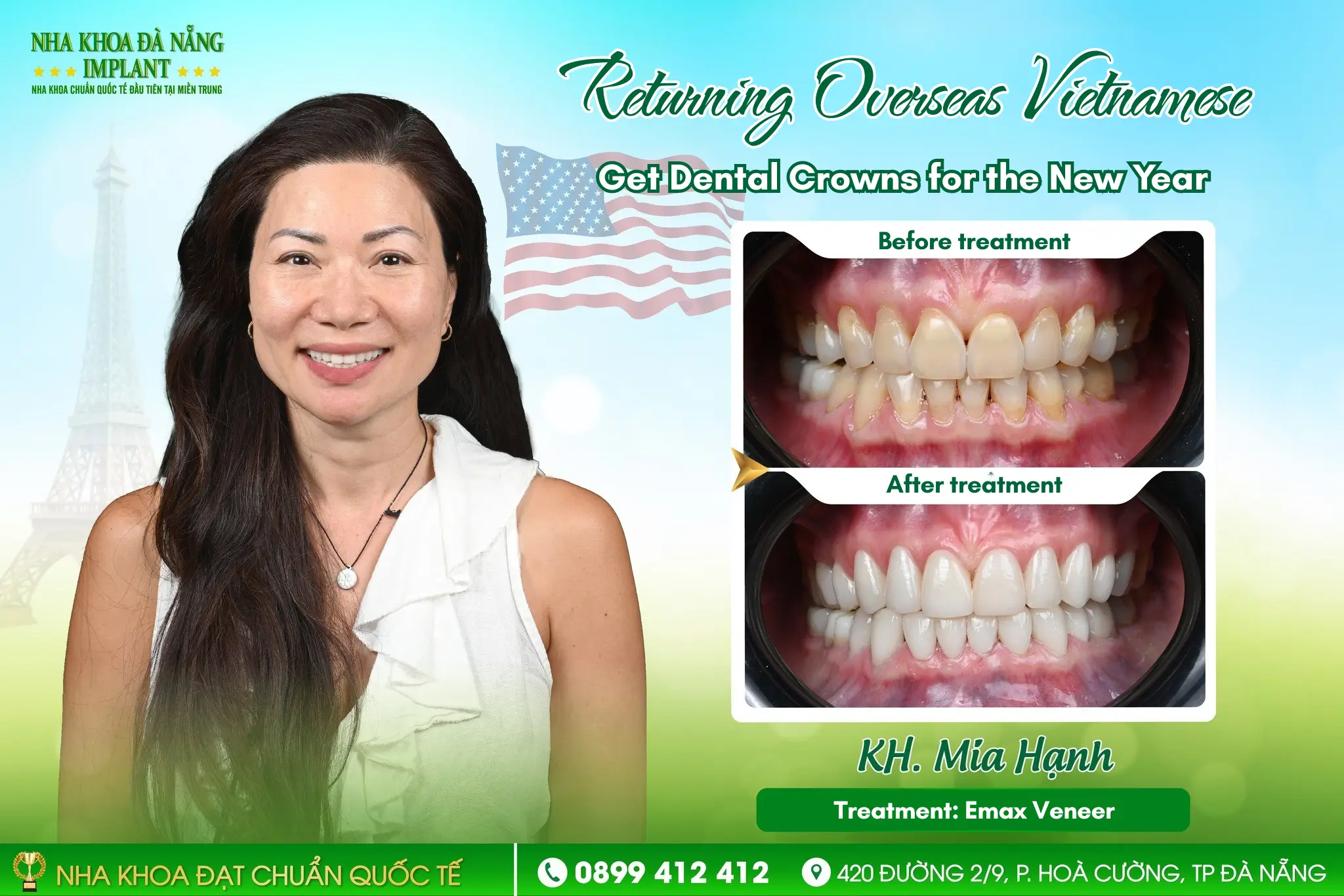 Results After Porcelain Crowns
