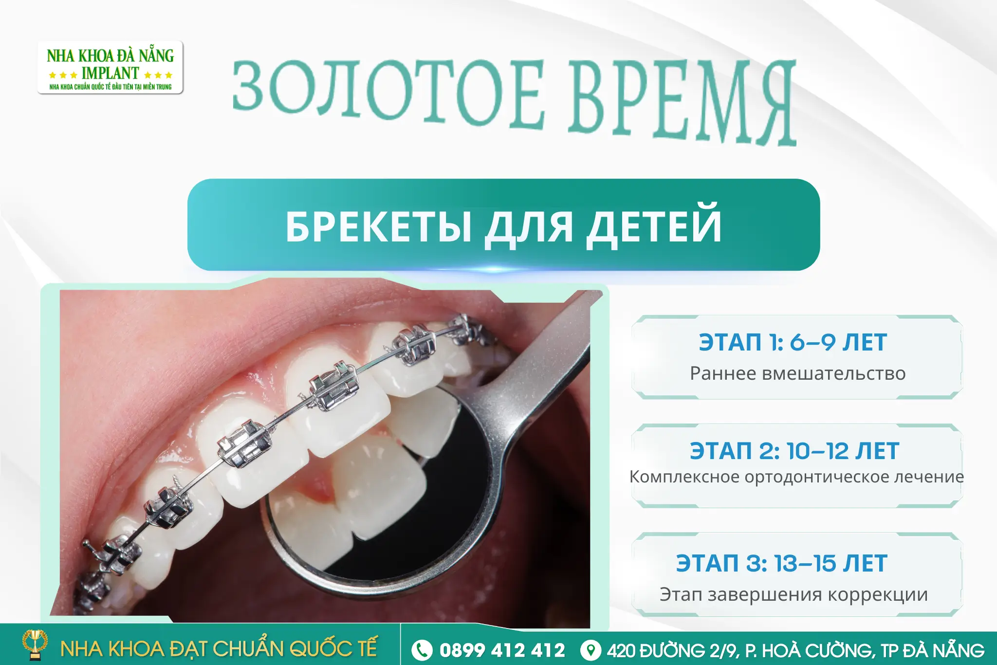 Когда следует ставить брекеты детям?