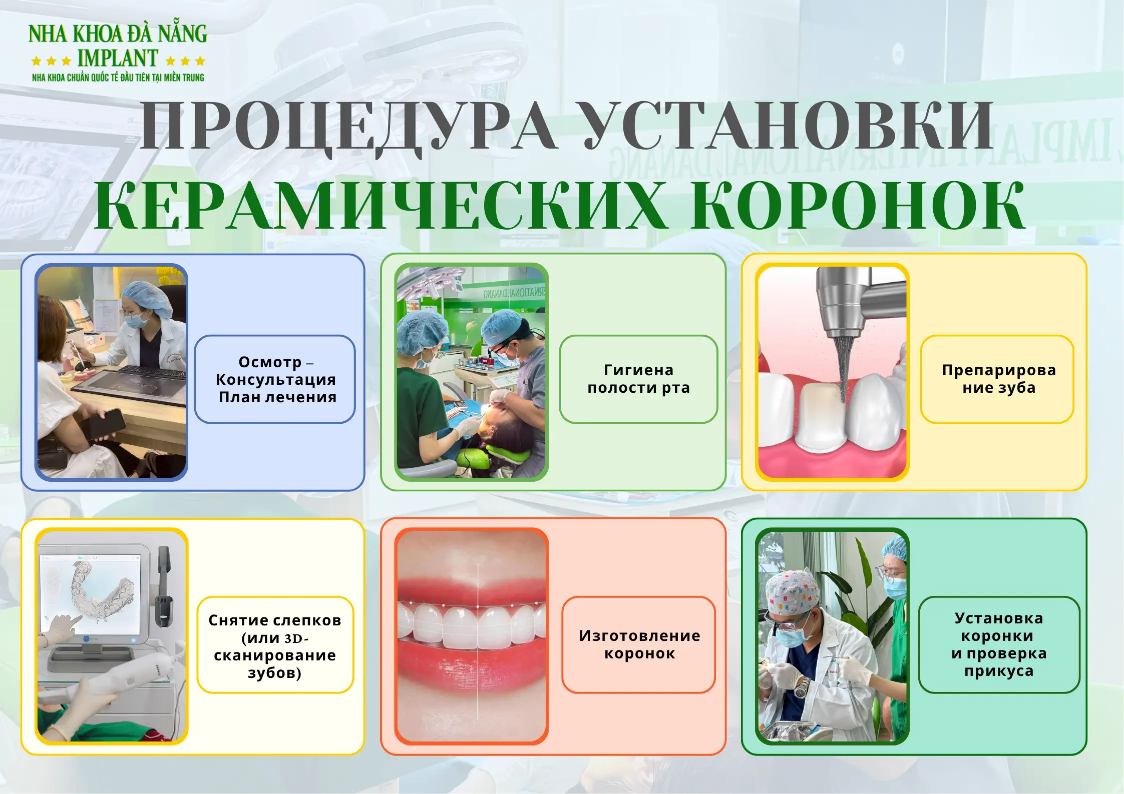 Процедура установки керамических коронок в стоматологии Da Nang Implant Dental Clinic