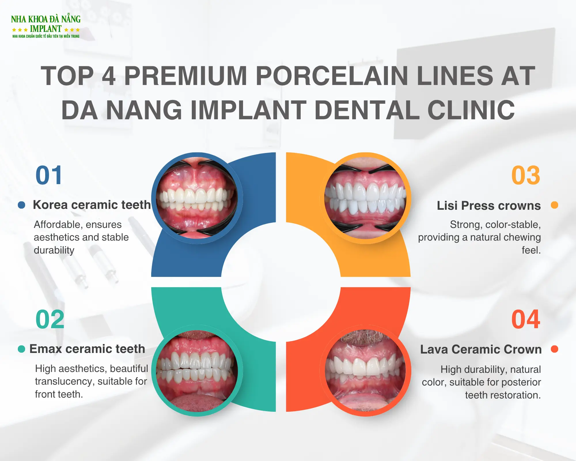 Experience in choosing the 4 most popular porcelain crown types today