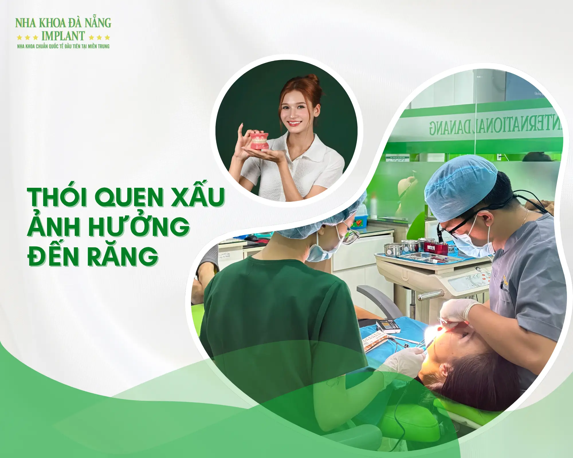 10 thói quen âm thầm làm hại răng bạn mỗi ngày - Cảnh báo từ Nha Khoa Đà Nẵng Implant