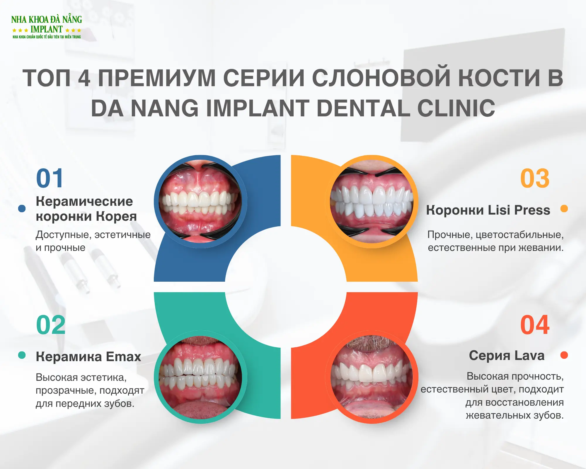 Опыт выбора 4 самых популярных видов керамических коронок