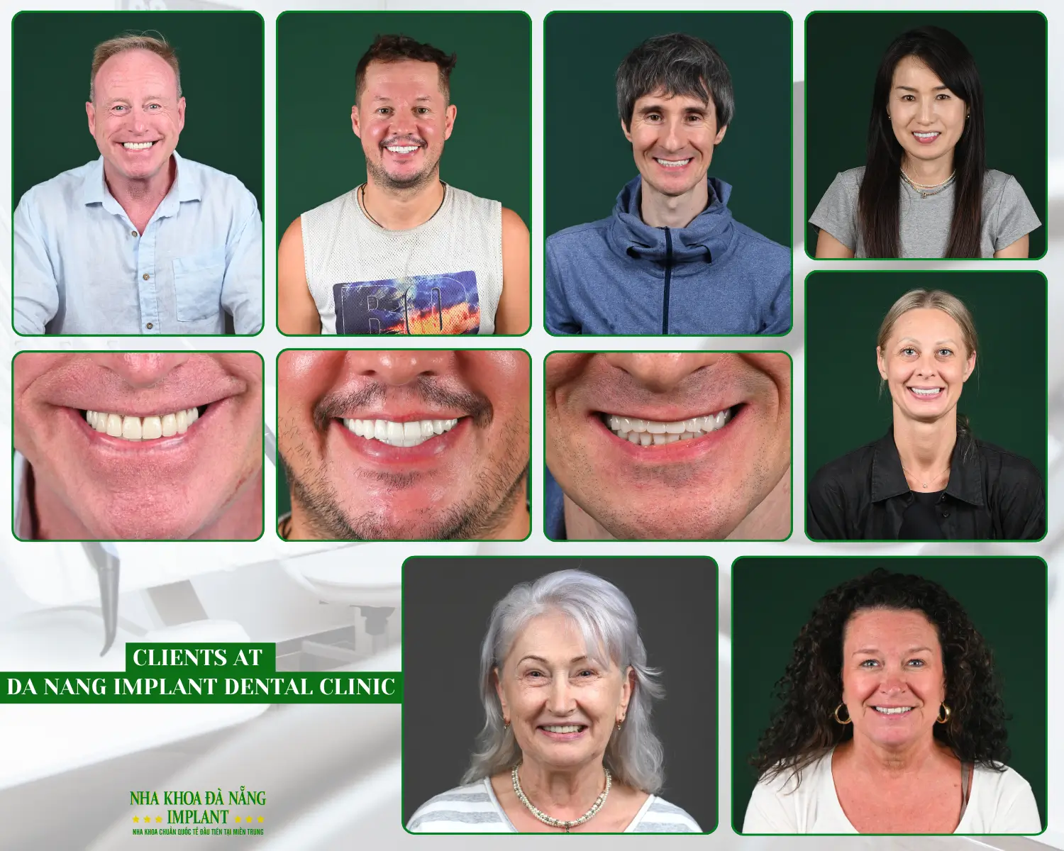 Real results from international clients – strong teeth, natural aesthetics, confident smiles