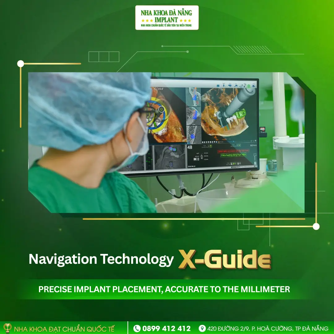 X-Guide Technology – Precise Implant Placement to the Millimeter