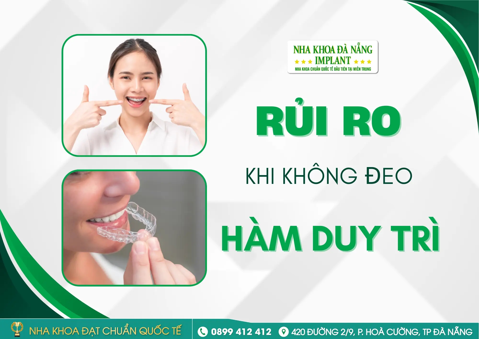 Vì sao bác sĩ luôn nhấn mạnh “đeo hàm duy trì”? Điều gì xảy ra nếu không đeo?