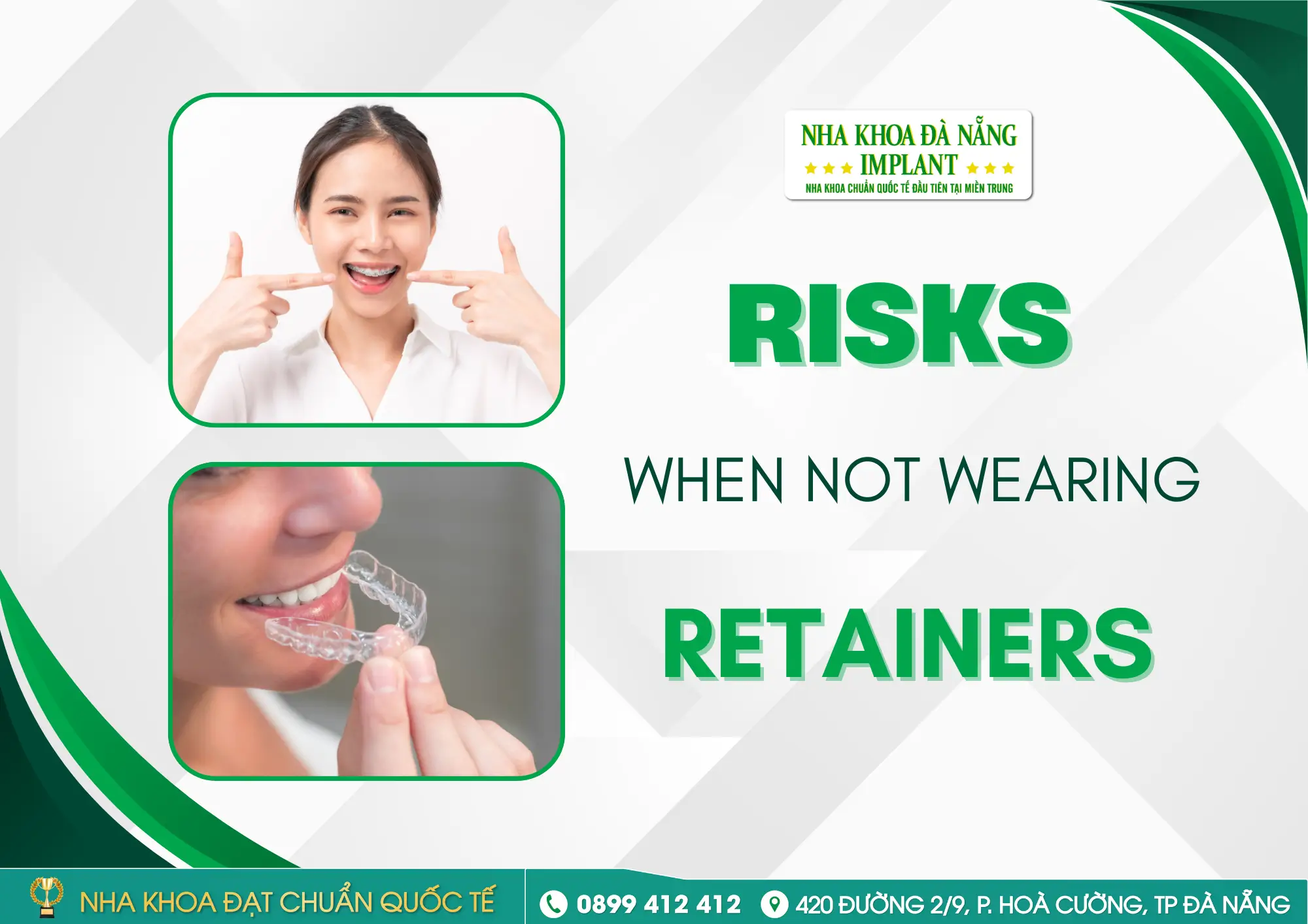 Why do doctors always emphasize “wearing retainers”? What happens if you don’t wear them?