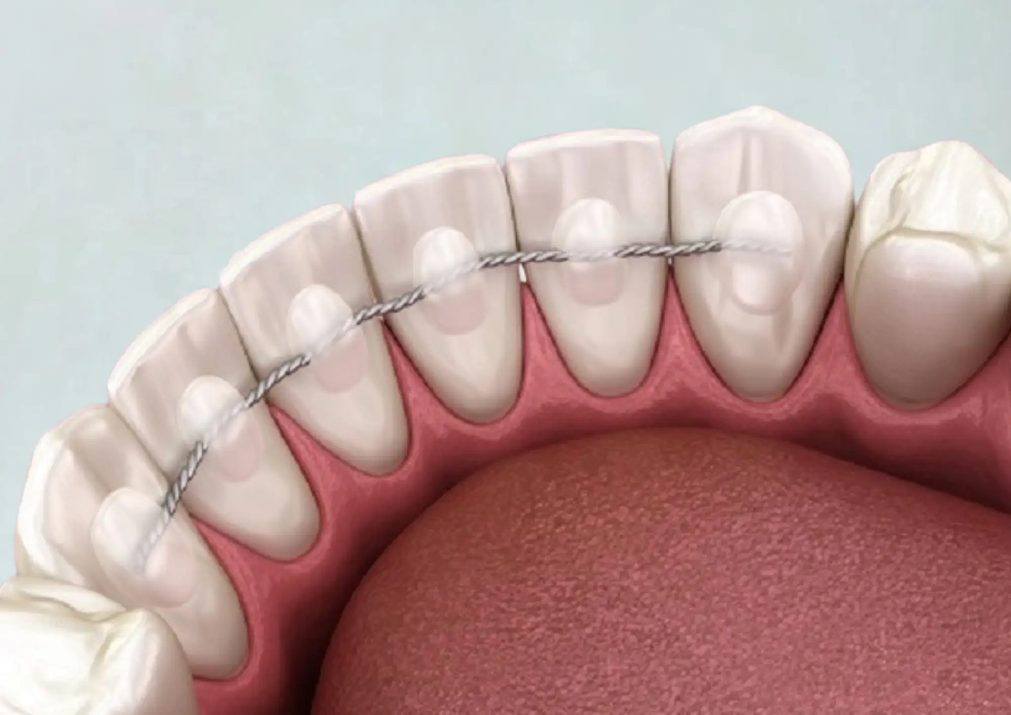 Hàm duy trì cố định