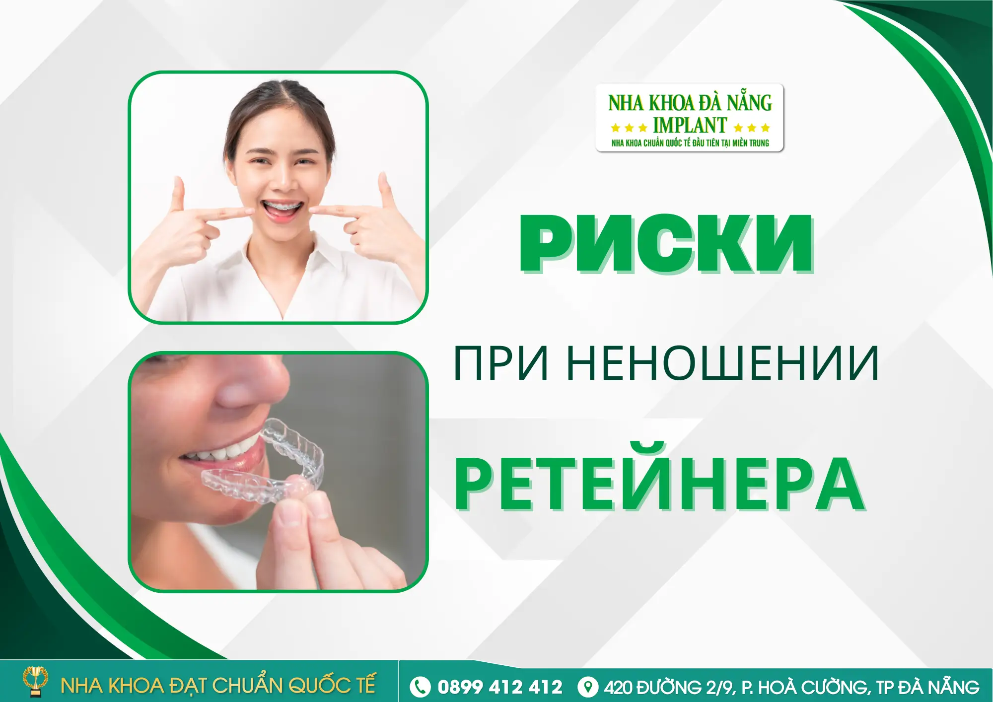 Почему врачи всегда подчёркивают необходимость «ношения ретейнера»? Что произойдёт если его не носить?