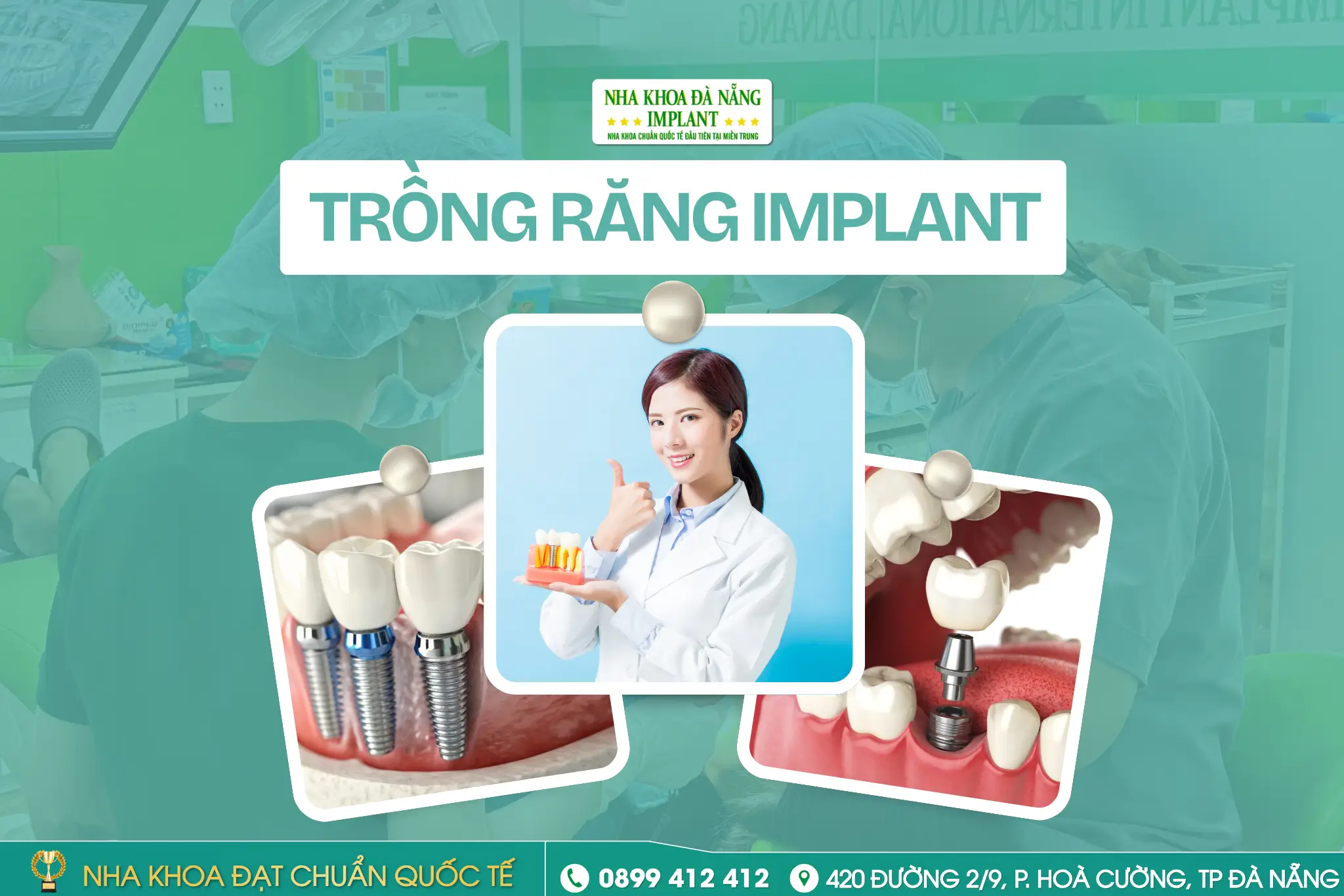 Trồng răng Implant bao lâu thì ăn nhai như răng thật? Giải thích chi tiết từng giai đoạn từ chuyên gia tại Nha Khoa Đà Nẵng Implant