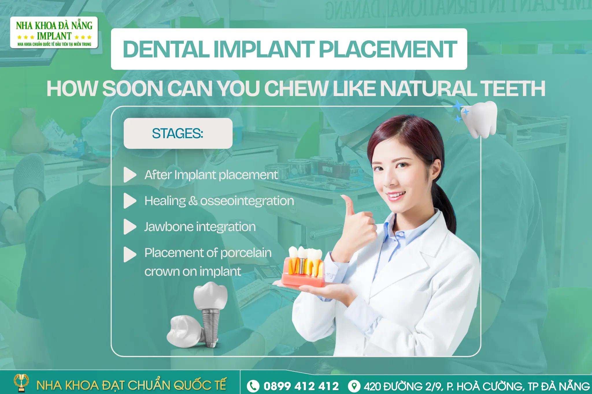 Stages of Chewing After Dental Implant Placement