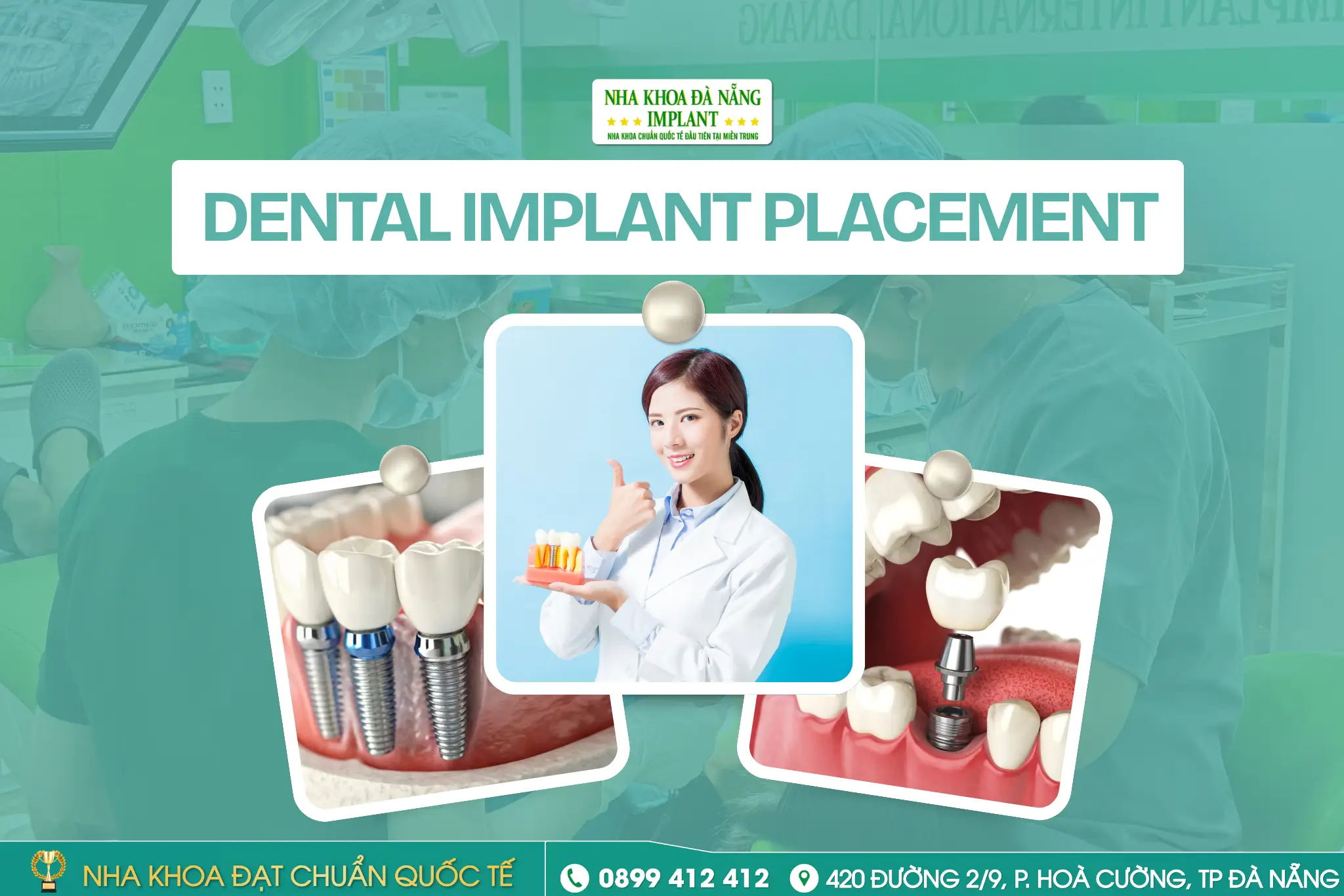 How Long Until You Can Chew Like Natural Teeth After a Dental Implant? Detailed Stage-by-Stage Explanation from Experts at Da Nang Implant Dental Clinic