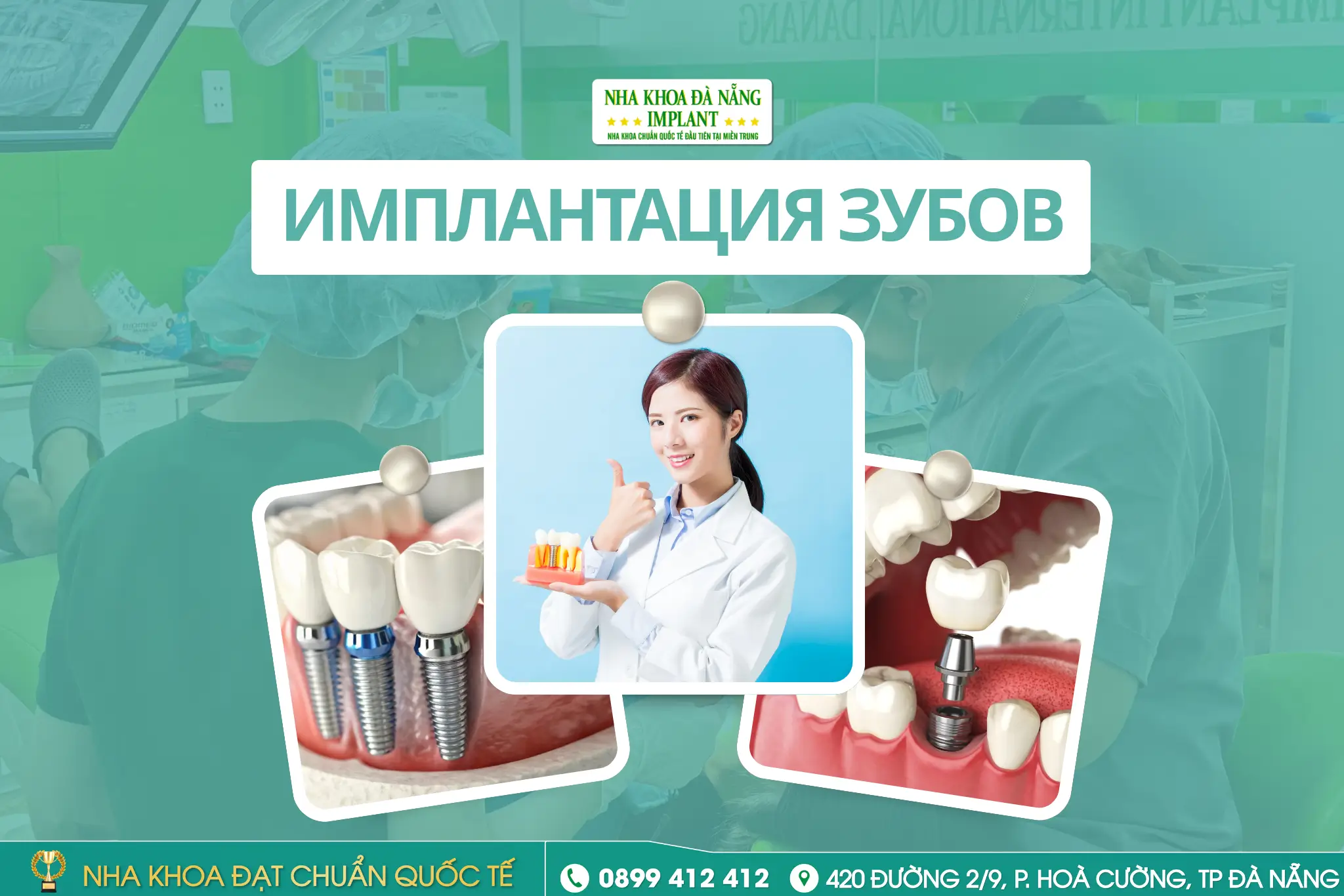 Сколько времени нужно чтобы жевать как своими зубами после имплантации? Подробное объяснение этапов от специалистов Da Nang Implant Dental Clinic