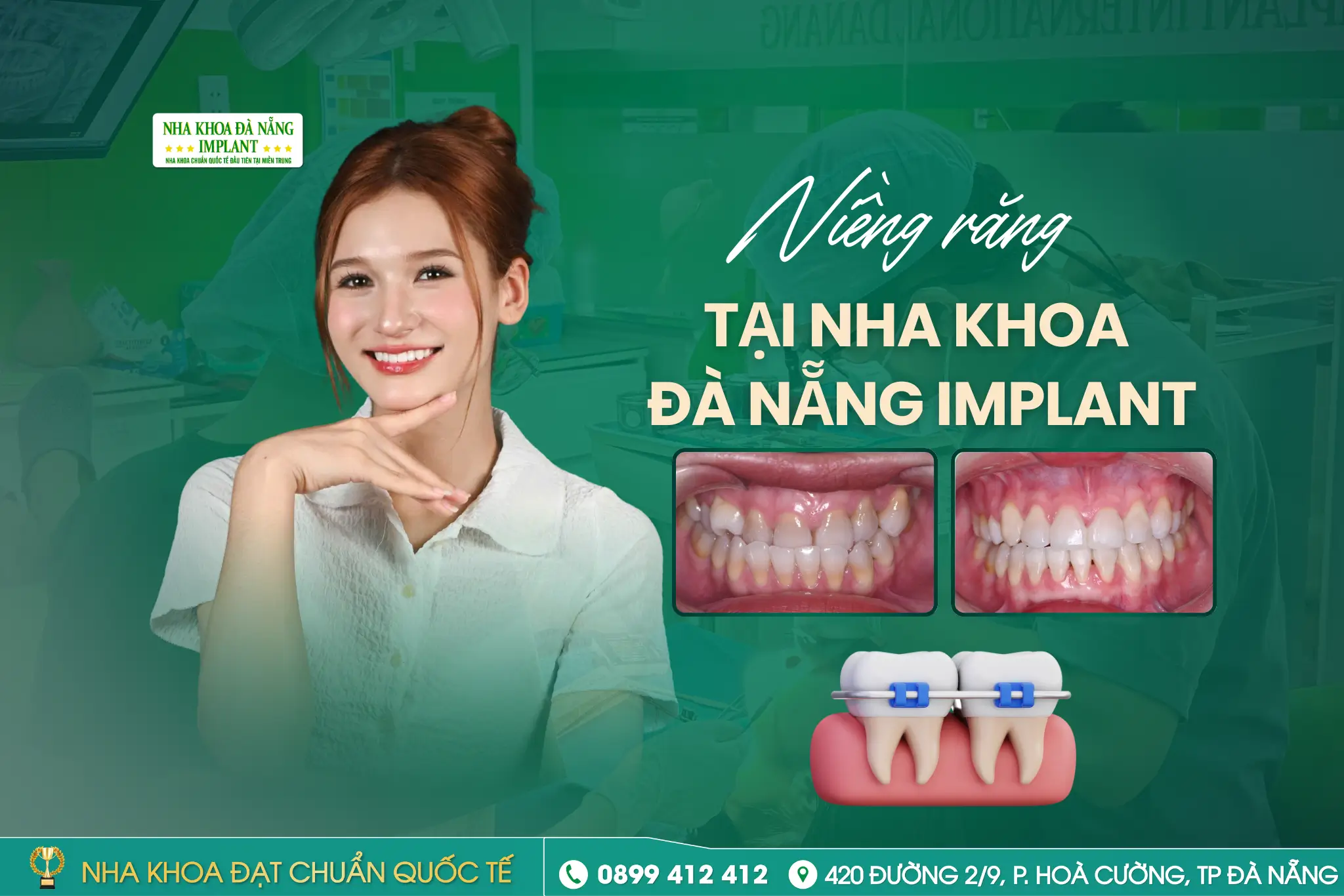 Niềng Răng Người Trưởng Thành Khác Gì Niềng Răng Tuổi Teen?