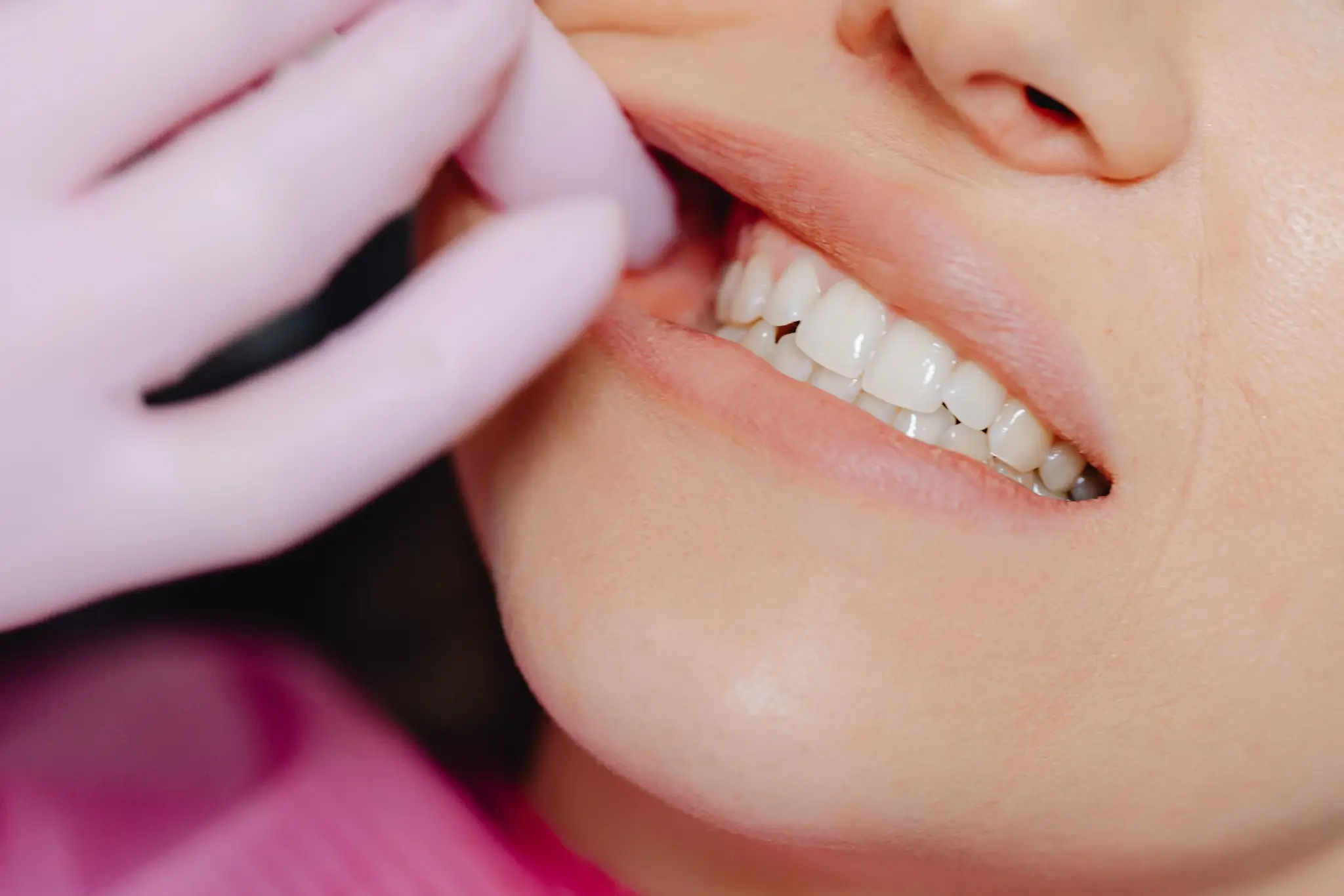 Khớp cắn chưa được điều chỉnh chính xác