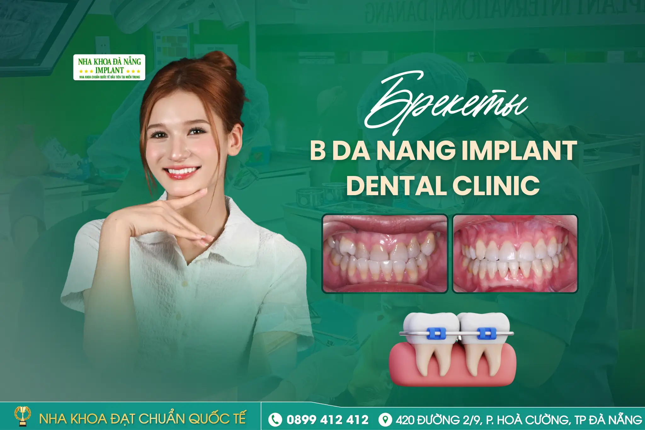 Чем отличается ортодонтическое лечение у взрослых от лечения в подростковом возрасте?