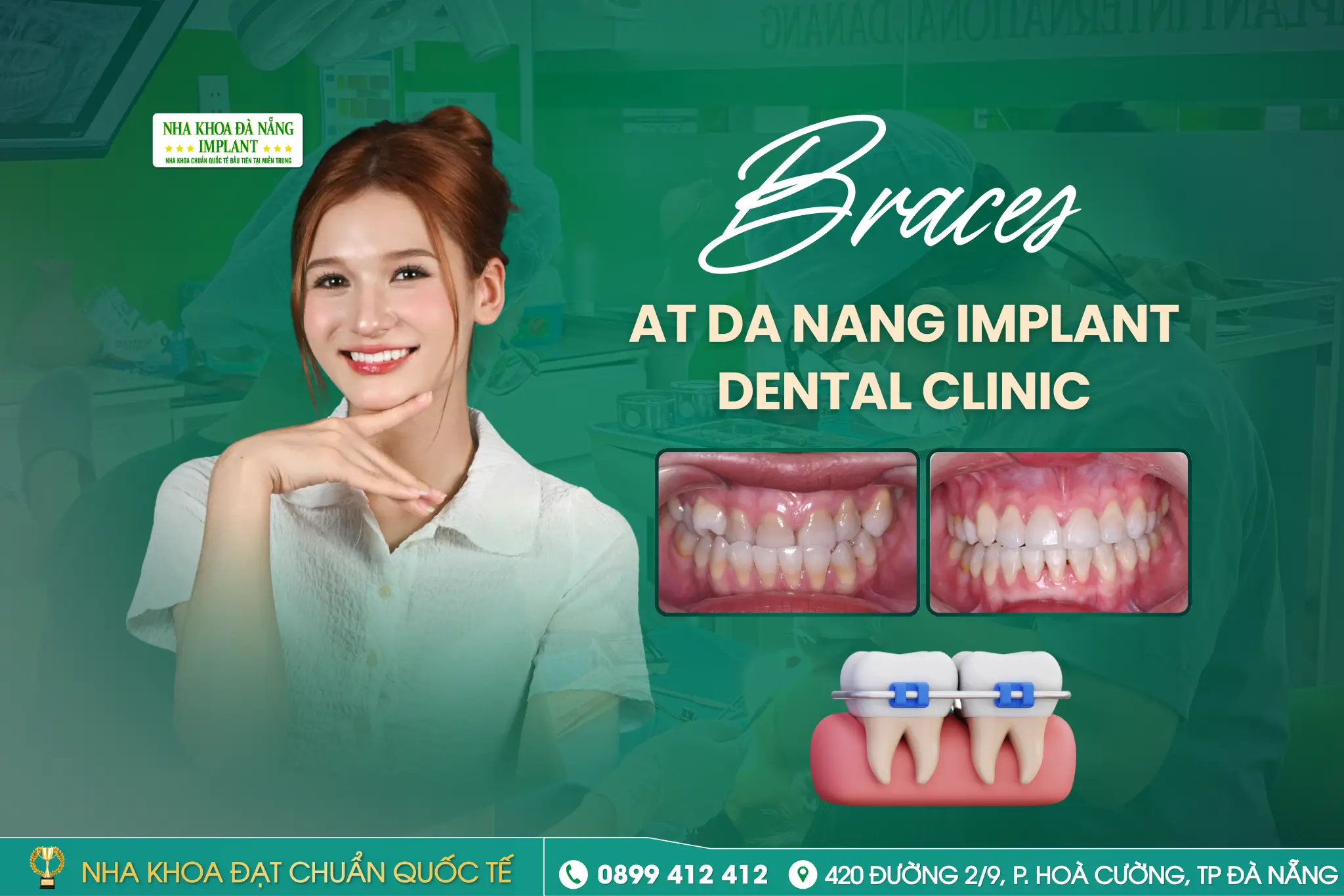 How Is Adult Orthodontic Treatment Different from Teen Orthodontics?