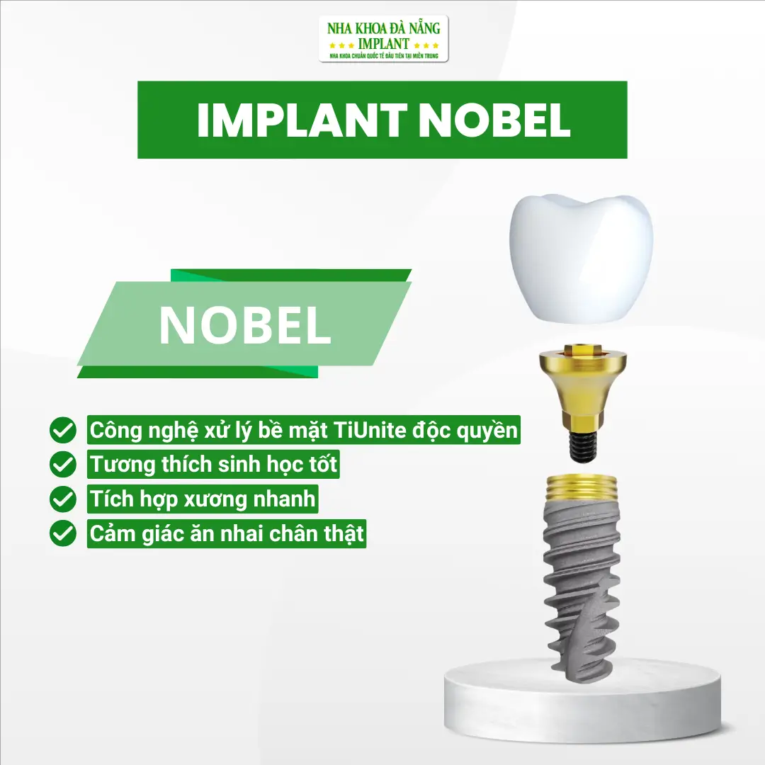 Bảng Giá Trụ Implant Mới Nhất Tại Nha Khoa Đà Nẵng Implant – Cập Nhật 2026 16 Trụ Implant Nobel (Mỹ)