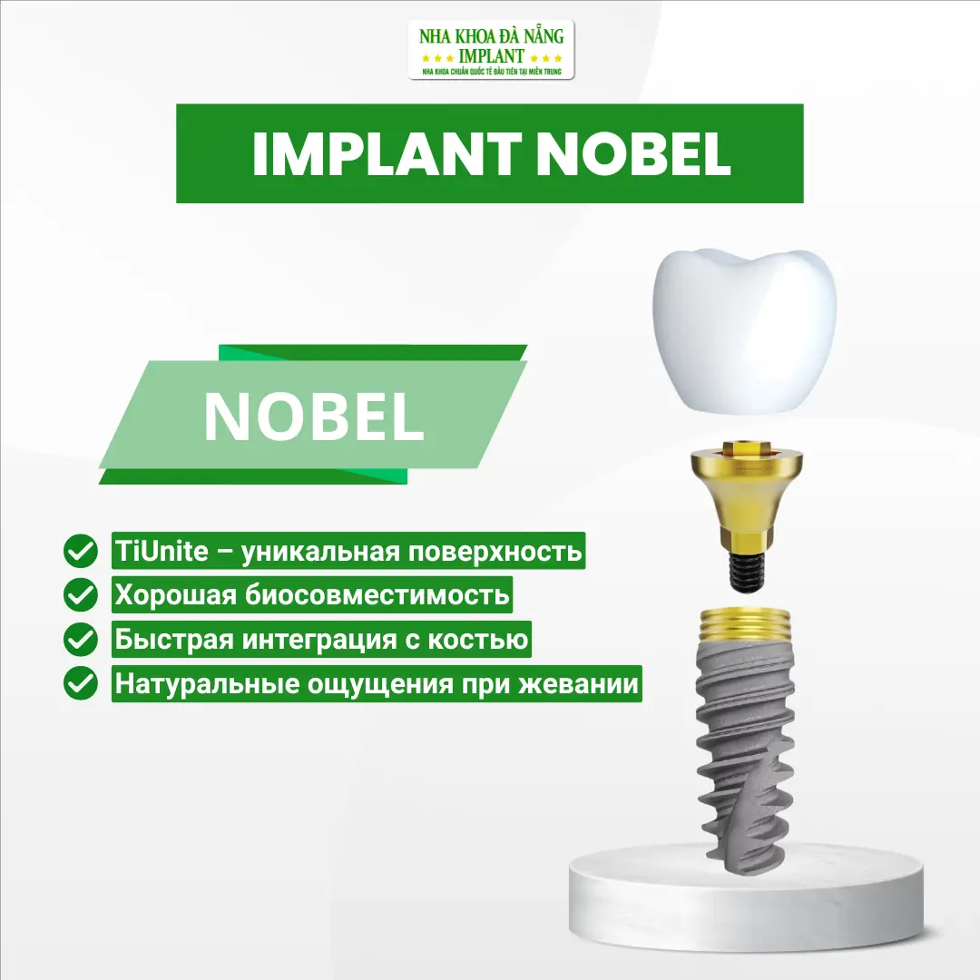 Имплант Nobel (США)