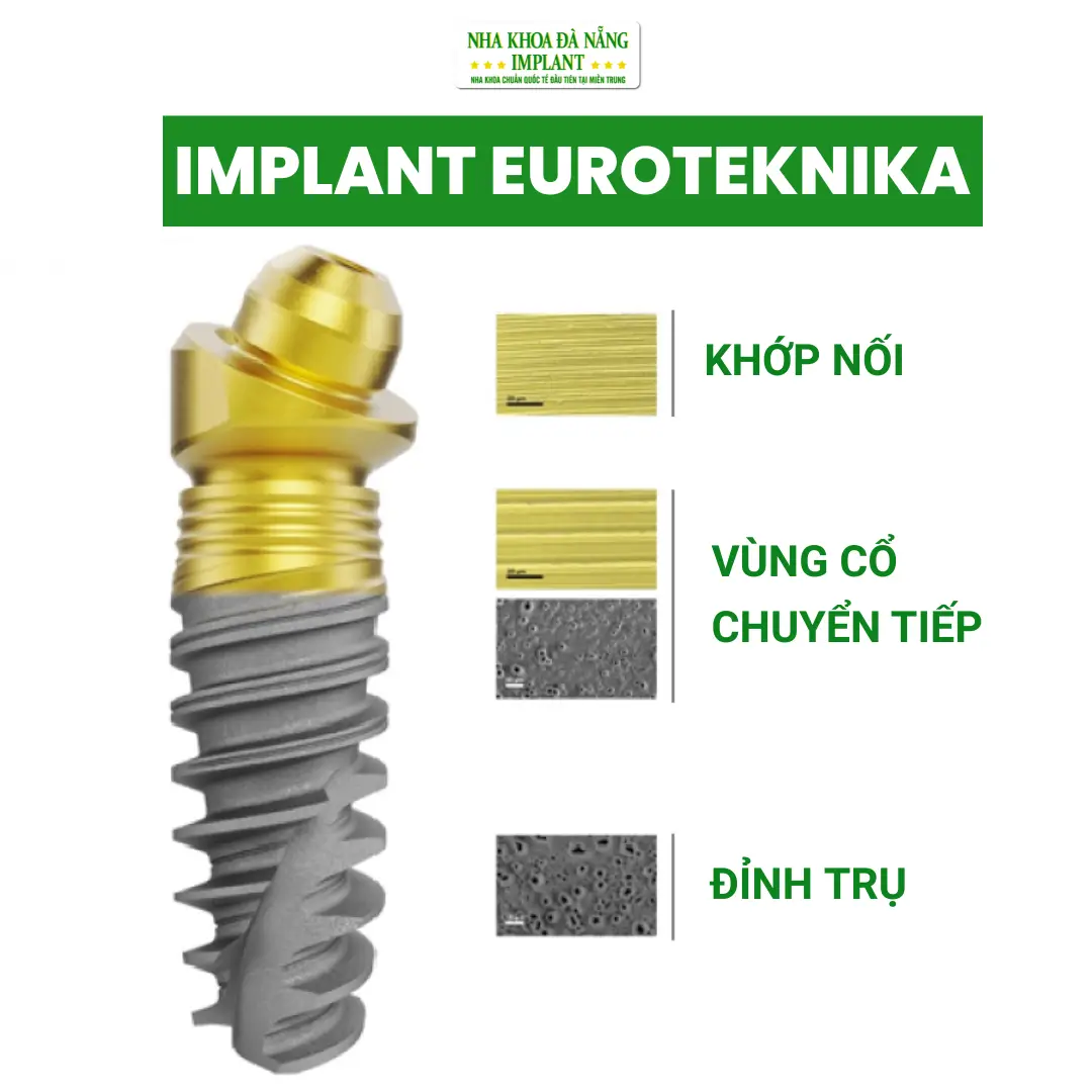 Bảng Giá Trụ Implant Mới Nhất Tại Nha Khoa Đà Nẵng Implant – Cập Nhật 2026 13 Trụ Implant Euroteknika (Pháp)