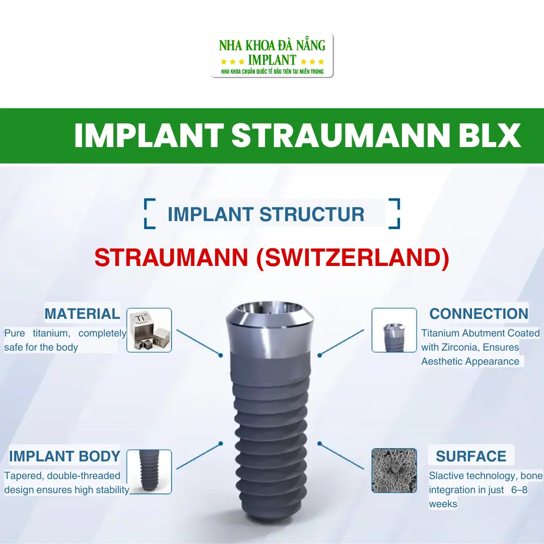 Straumann BLX Implant (Switzerland)