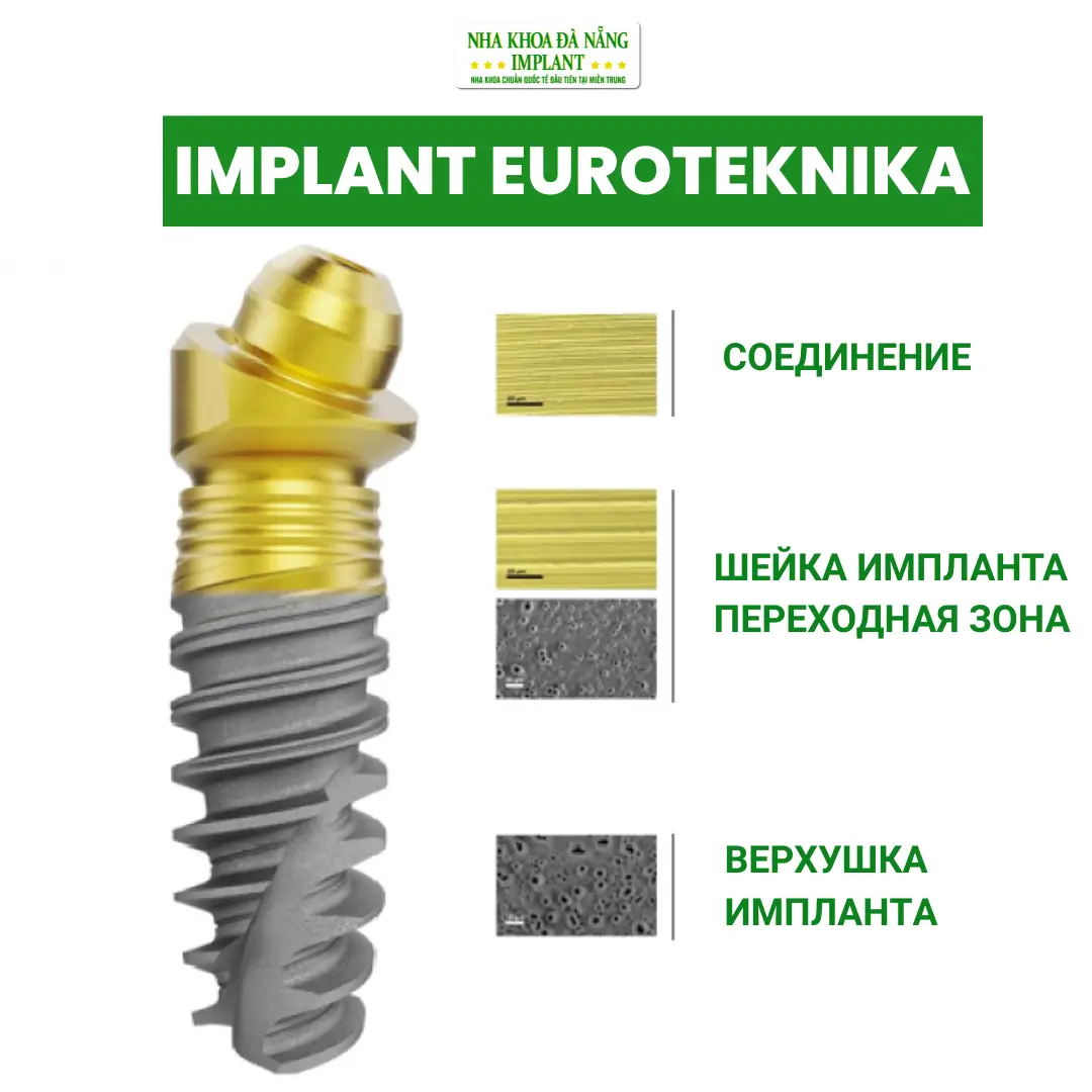 Имплантат Euroteknika (Франция)
