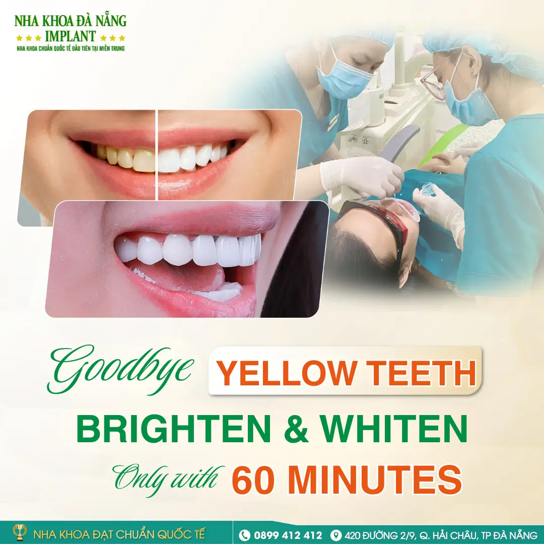 Teeth Whitening – Quickly Enhance Your Smile