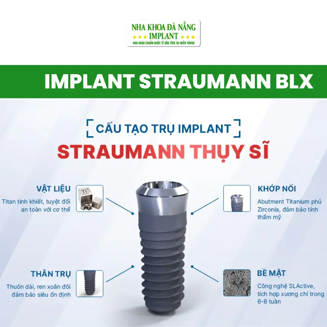 Bảng Giá Trụ Implant Mới Nhất Tại Nha Khoa Đà Nẵng Implant – Cập Nhật 2026 19 Trụ Implant Straumann BLX (Thụy Sĩ)