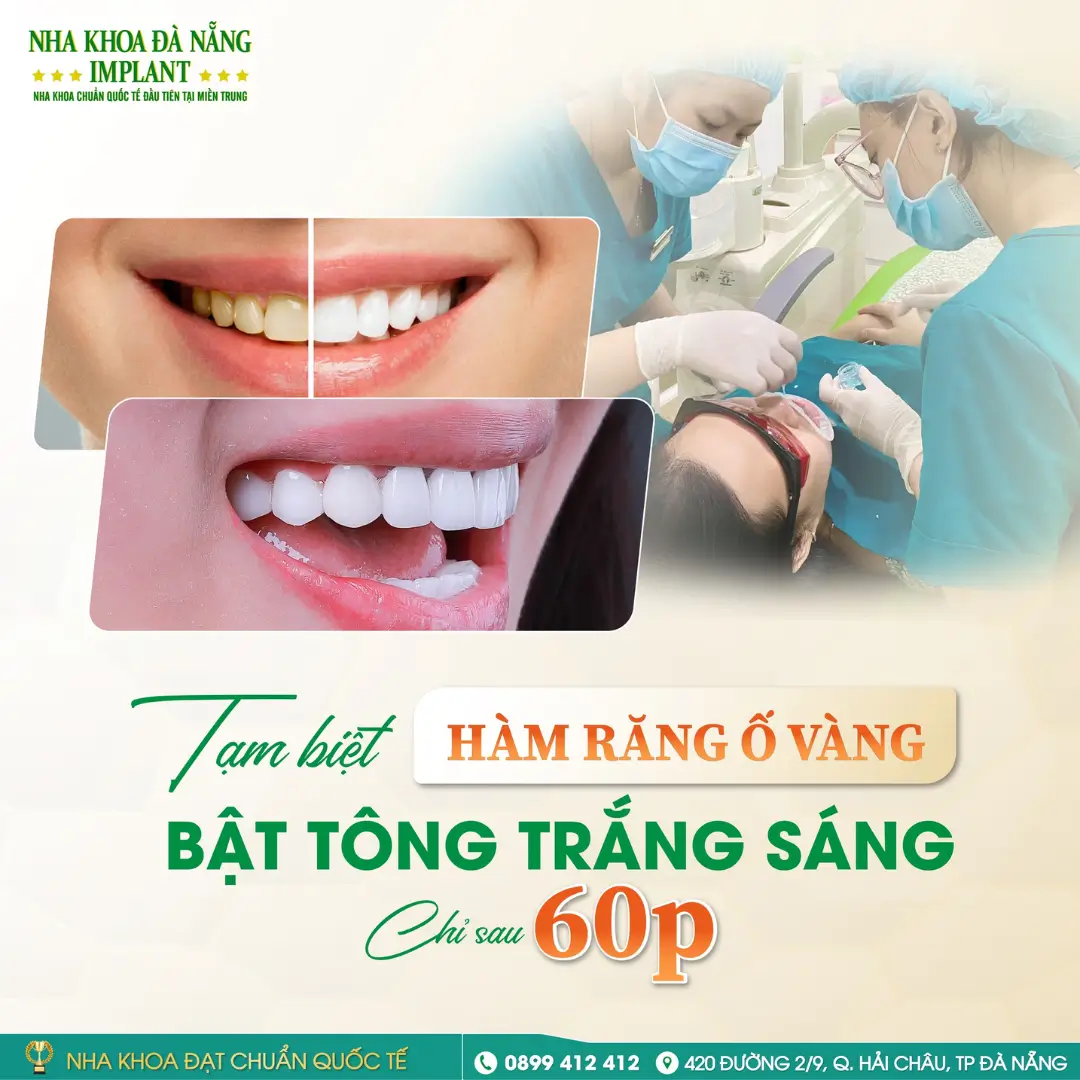 Làm Răng Đón Tết: Nên Chọn Giải Pháp Nào Để Kịp Thời Gian? 9 Tẩy Trắng Răng – Cải Thiện Nụ Cười Nhanh Chóng