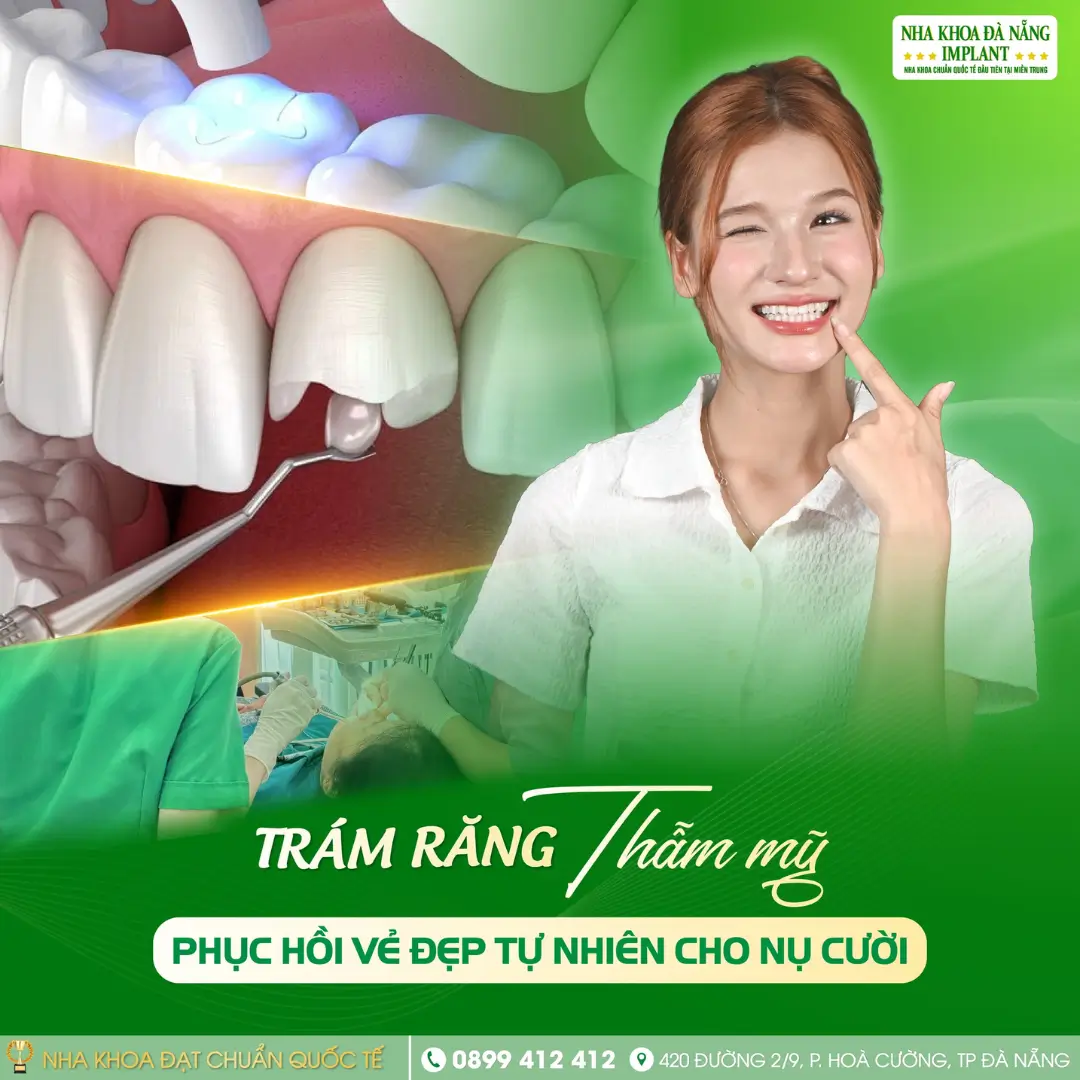 Làm Răng Đón Tết: Nên Chọn Giải Pháp Nào Để Kịp Thời Gian? 13 Trám Răng Thẩm Mỹ – Giải Pháp Nhanh, Gọn, Tiết Kiệm