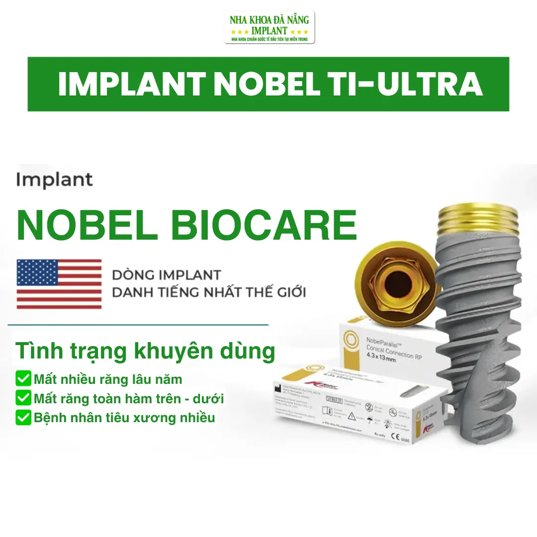 Bảng Giá Trụ Implant Mới Nhất Tại Nha Khoa Đà Nẵng Implant – Cập Nhật 2026 18 Trụ Implant Nobel Ti-Ultra (Mỹ)