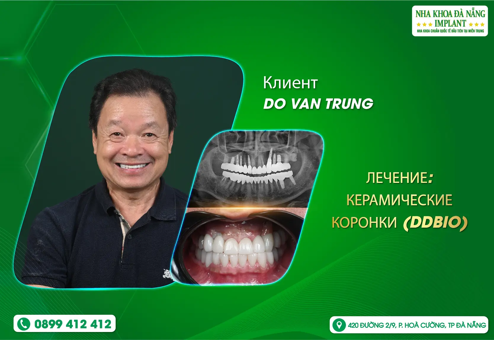 Вьеткью вернулись на родину и выбрали Da Nang Implant Dental Clinic
