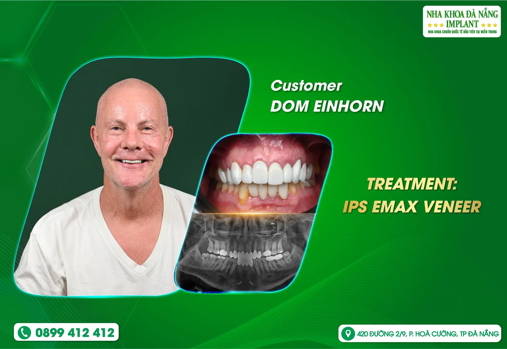 “The best dentist of my life” – The transformation journey of customer DOM EINHORN