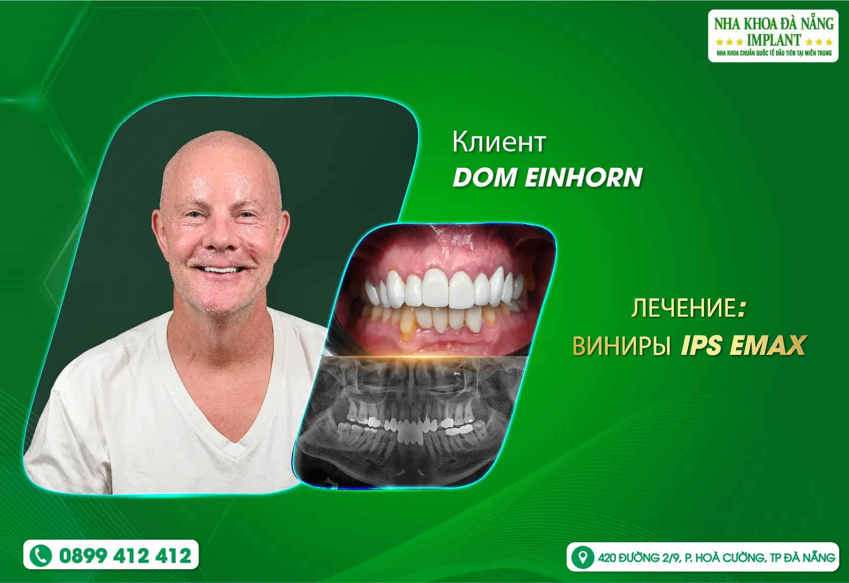 «Лучший стоматолог в моей жизни» — путь преображения клиента DOM EINHORN