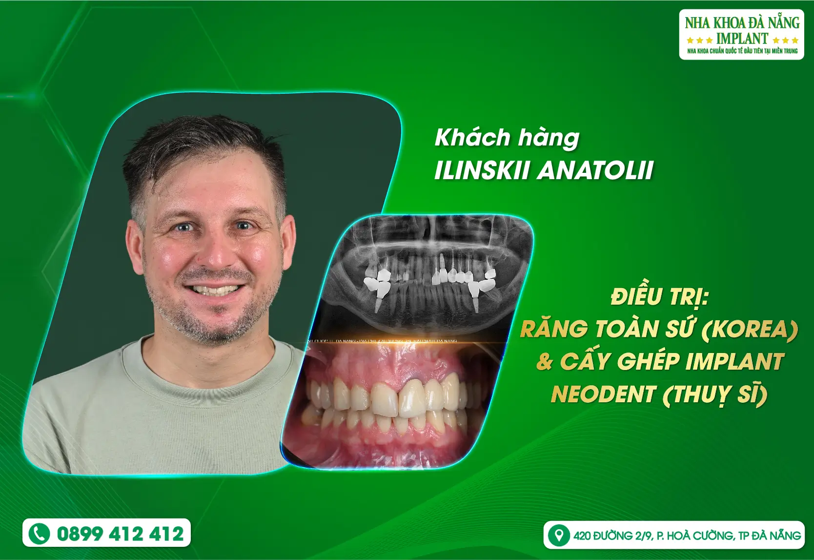 An tâm điều trị tại Nha Khoa Đà Nẵng Implant