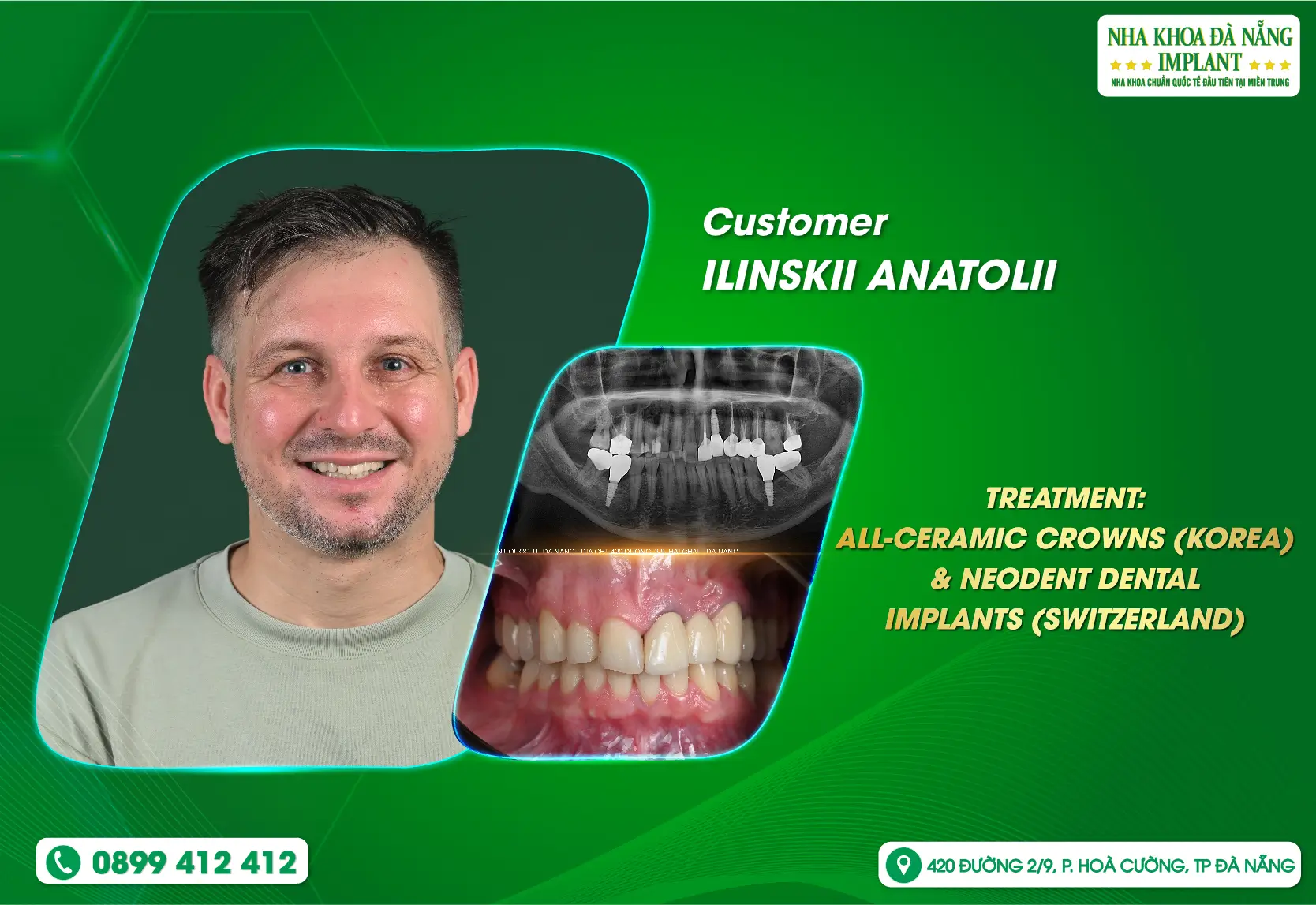 Peace of mind during treatment at Da Nang Implant Dental Clinic.