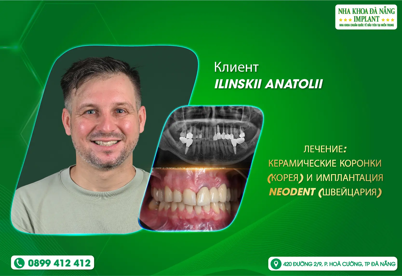 Спокойствие во время лечения в стоматологической клинике Da Nang Implant.