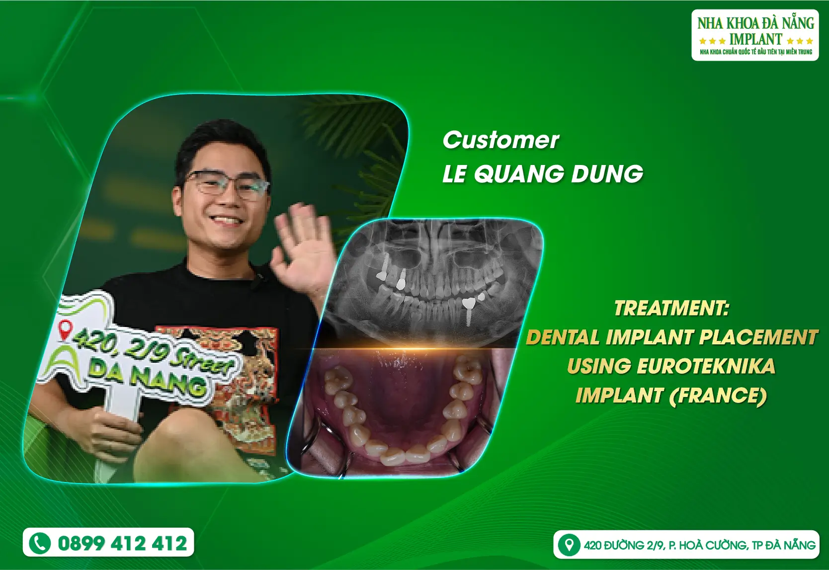 Not only satisfied with the results, but also at ease throughout the treatment process.